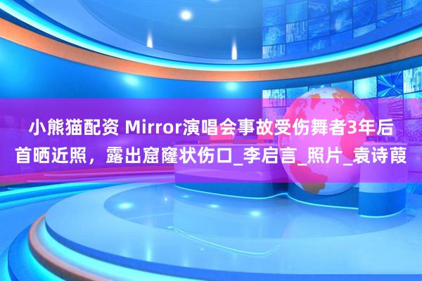 小熊猫配资 Mirror演唱会事故受伤舞者3年后首晒近照,露出窟窿状伤口_李启言_照片_袁诗葭